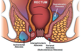 Anal Apse